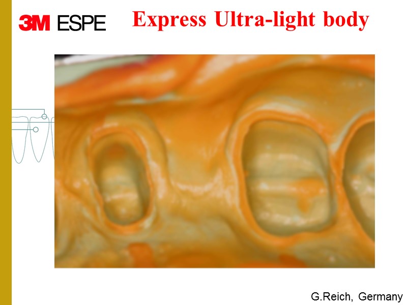 G.Reich, Germany Express Ultra-light body